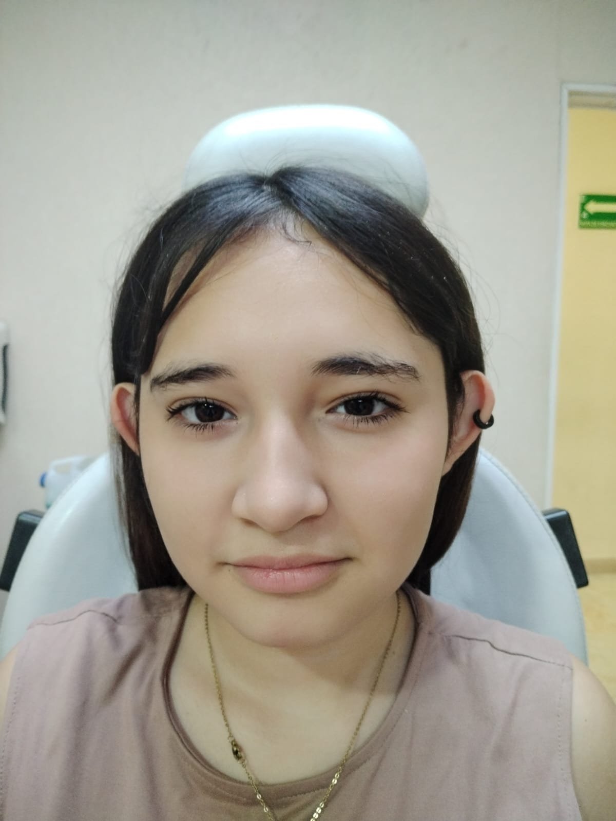 Resultados de Otoplastia